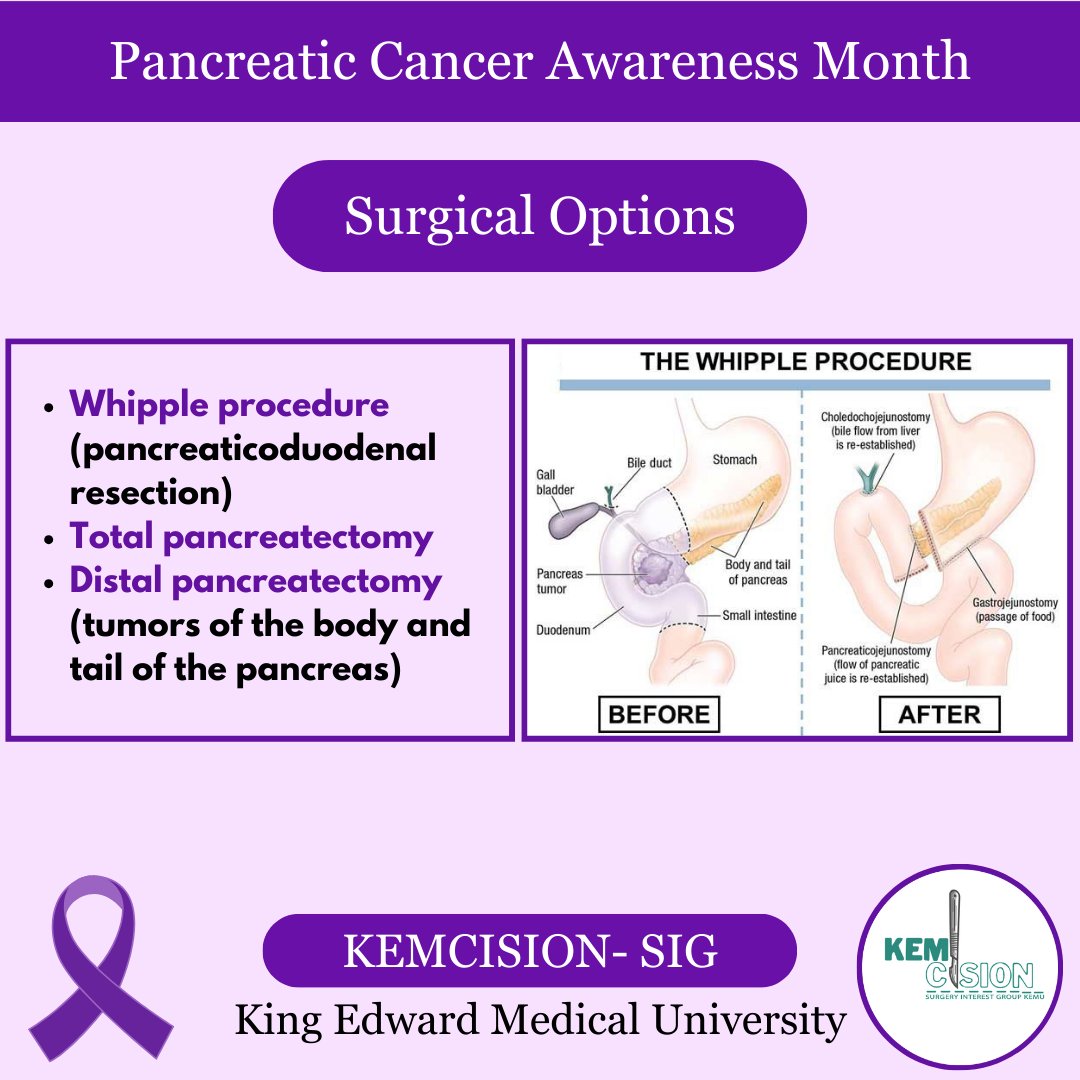 sigkemu's tweet photo. Awareness of symptoms and signs, and risk factors is important for early detection of pancreatic cancer.
#pancreaticcancer
#November #pancreaticcancerawarenessmonth #surgery #surgicaltreatment #kemcision https://t.co/JNRnhGYena