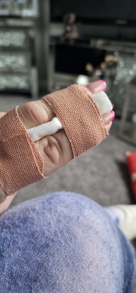 RuthTucker1's tweet photo. When you think its a good idea to help @iamNathanMoore back on stage .... #brokenfinger xx https://t.co/uDia8RnqlM