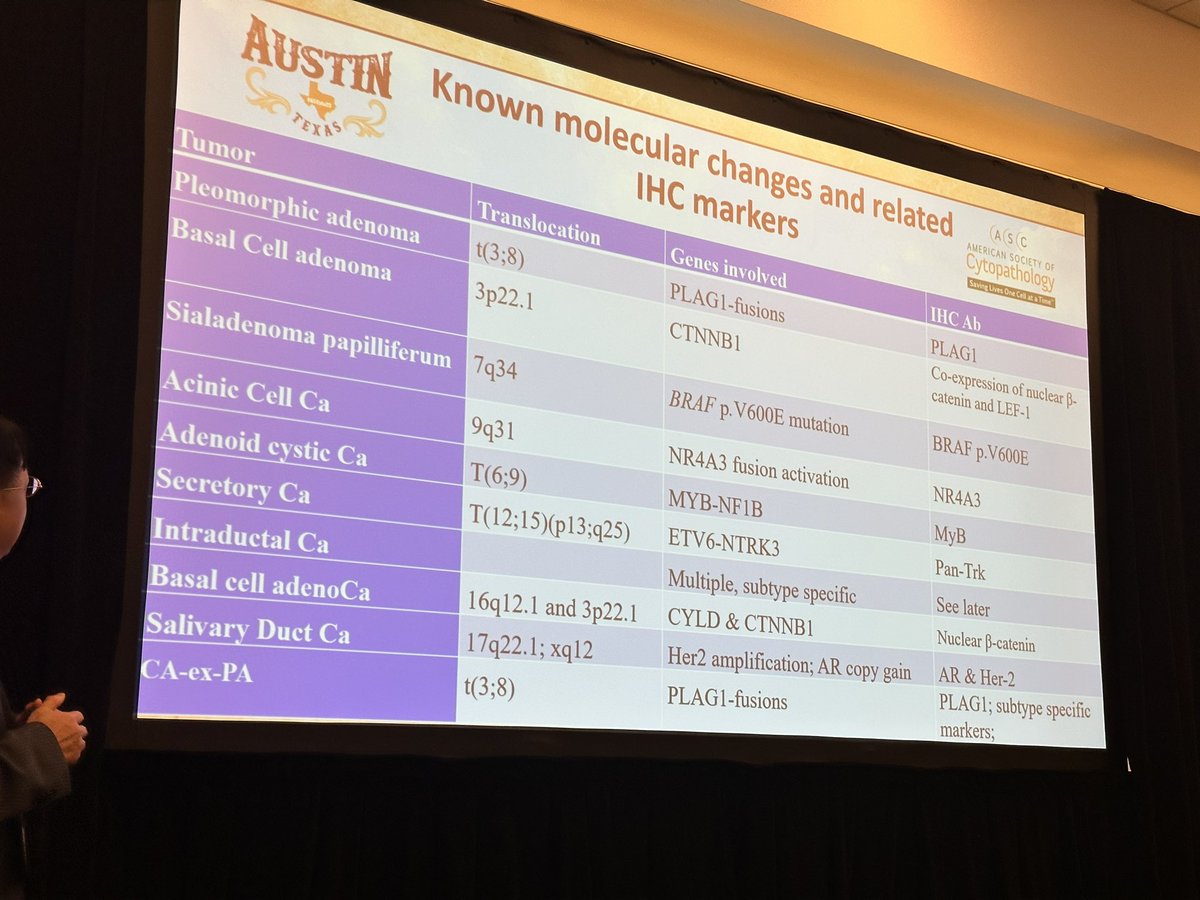 Sinchita Roy MD PhD (@sinchita_roy) on Twitter photo Next generation #IHCpath in salivary gland <a href="/CAPA_comm/">Chinese American Pathologists Association</a> Dr. He (Peter) Wang Very nice summary of ancillary studies that can help in diagnosis Next generation #IHCpath in salivary gland <a href="/CAPA_comm/">Chinese American Pathologists Association</a> Dr. He (Peter) Wang Very nice summary of ancillary studies that can help in diagnosis