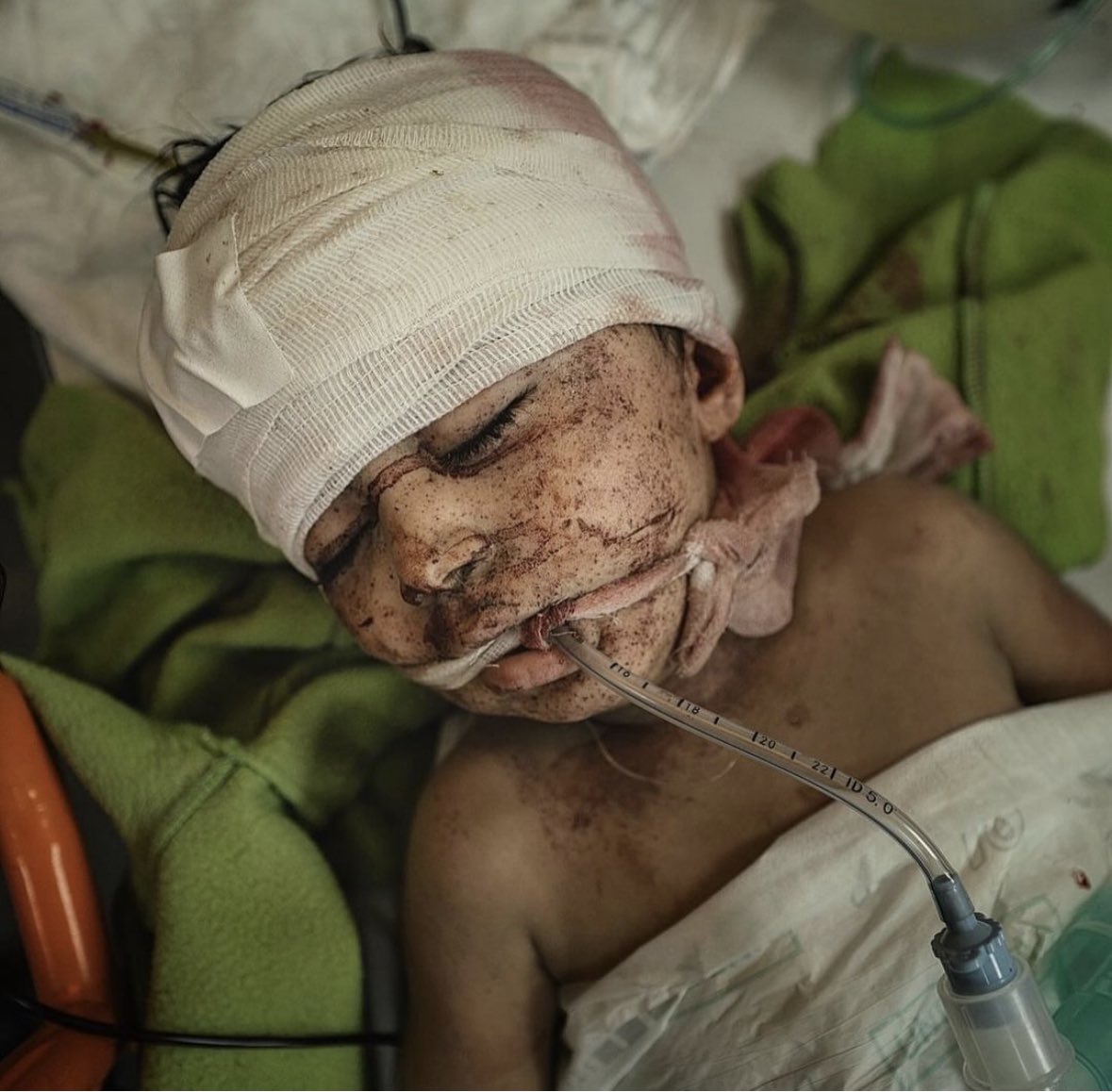 Sad times we are in. I don’t care what side you stand on there should never be a moment in time where children’s deaths are a product of man’s hunger for money and greed! #FreePalestine #SaveThePalestinians