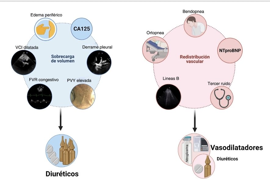 LeslieMegom's tweet image. 🔰Una excelente revisión 🫀💧Congestión e inflamación 💥⬆️en la insuficiencia cardíaca🫀: Cuantificación y tratamiento💊 de la congestión en insuficiencia cardíaca: una visión clínica y fisiopatológica.💧
👇👇👇👇👇
revistanefrologia.com/es-cuantificac…
🗝🔒
acrobat.adobe.com/link/track?uri…