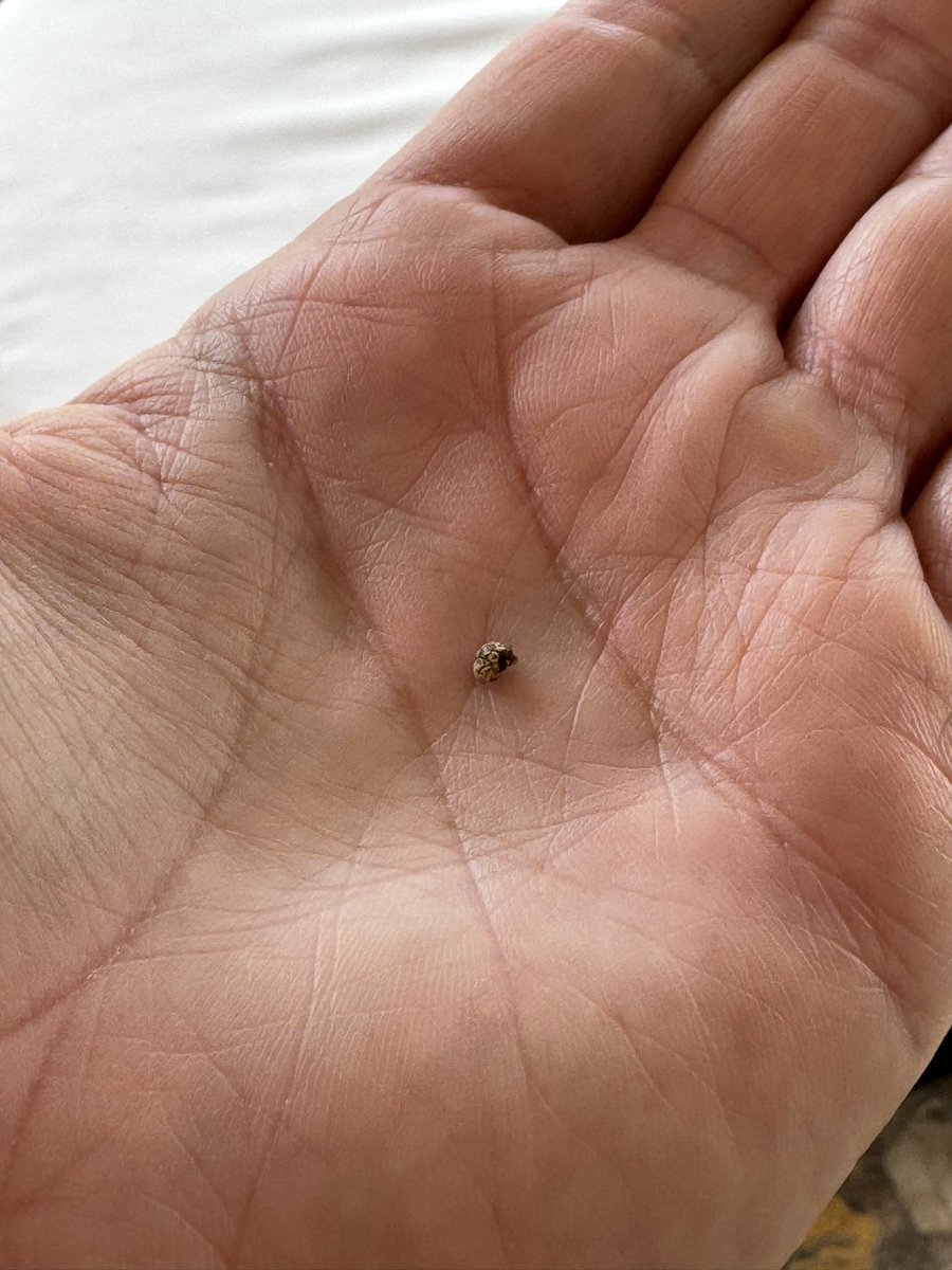 raulgtzoficial's tweet photo. De nuevo el limón🍋 y el aceite de oliva 🫒 lo volvieron a hacer 👏🏻! Hace ya unos meses me habían recomendado tomar todas las mañanas en ayuno un jugo de limón con una cucharada 🥄 sopera de aceite de oliva para expulsar un lito que tenía en el riñón, debo confesar que lo hice con muy poca fe en aquella ocasión y al paso de una semana resultó! 😱, sin embargo me habrían quedado dos piedritas más en los ductos, por lo que hace tres días (luego de que las molestias regresaran) inicié el “tratamiento” (ojalá no me lea ningún médico 🤭) y ahí les voy, limón y aceite de oliva en ayunar! Y que creen? Chan-chan! 💥 la poesías acaba de salir hace unos minutos! No es un tratamiento, diría yo un remedio, que a mi me resultó, es eficiente cuando la piedrita o litio resulta ser pequeña! Y ahora si como comercial (si las molestias persisten, consulten a su médico) 🧑🏼‍⚕️🙏🏻✨