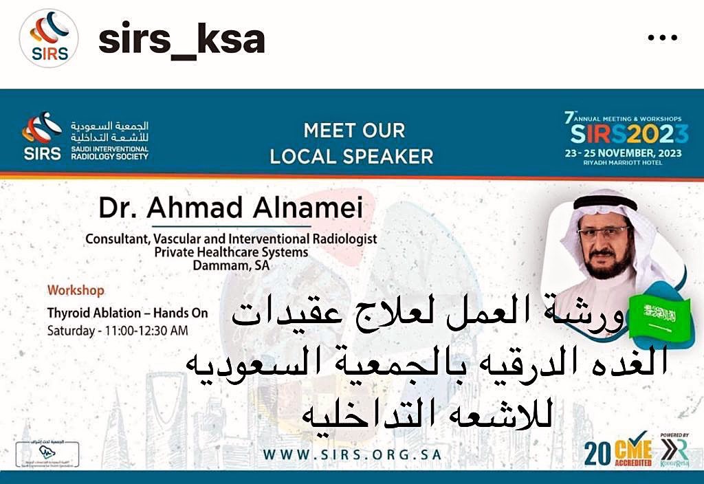 علاج عقيدات الغدة الدرقية و هي عقد صلبه او محملة بالسوائل تنشأ داخل الغدة الدرقية. استشاري الاشعة التداخلية الان لهم دور فعال لعلاج العقيدات الحميدة في الغدة الدرقية بأحدث التقنيات عن طريق التردد الحراري كبديل للجراحة و بدون شقوق جراحية و سرعة التعافي دون التأثير علي وظائف الغدة.