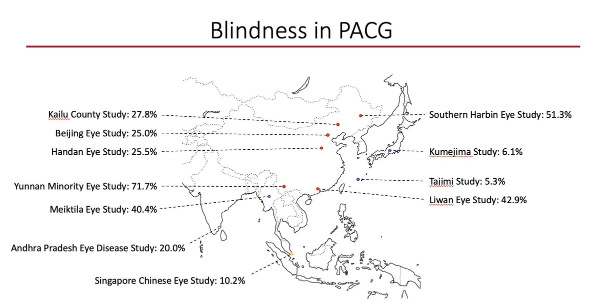 One out 4 people with primary #angleclosure #glaucoma (#PACG) suffers from blindness. This problem is greatest in Asia.  However, until recently, little was known about the impact of this visually devastating but largely preventable disease in the United States. #Ophthalmology