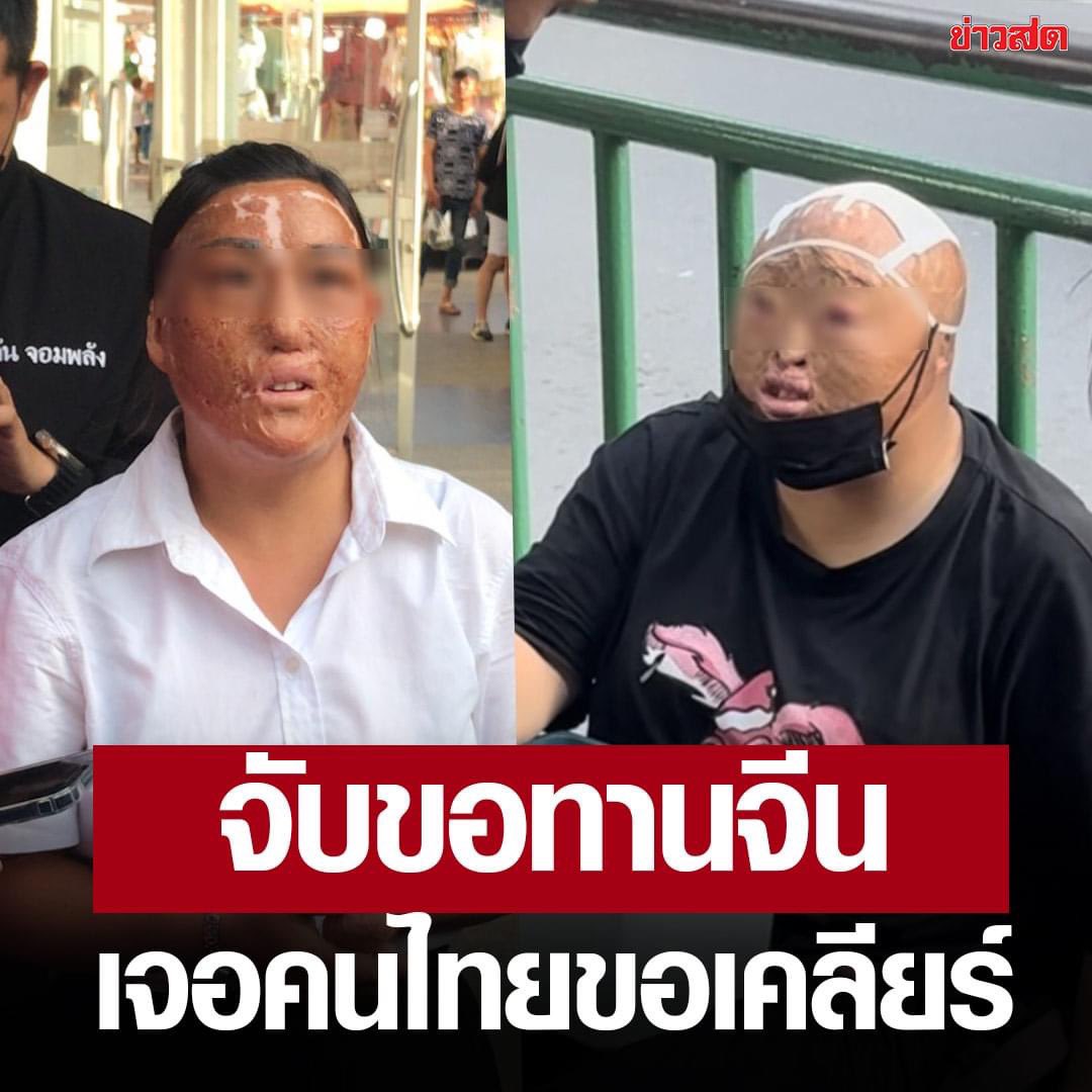 RedSkullxxx's tweet photo. จับขอทานจีน อึ้งค้นเจอเงิน 1 หมื่น แถมมีคนไทยโผล่มาขอเคลียร์
.
คนจีนทุกคนมีอายุมากกว่า 40 ปี จะใส่ชุดนักเรียนไทยเพื่อเรียกความสงสาร ต่อมามีหญิงชาวไทยคนหนึ่งอ้างตัวว่าเป็น��่ามของขอทานคนจีน และมาขอเคลียร์กับตำรวจ พร้อมกับจ่ายเงินประกันเพื่อขอให้ปล่อยตัว แต่ตำรวจก็ไม่ได้มีการปล่อยตัวไปแต่อย่างใด

ทั้งนี้มีข้อมูลว่า ขอทานแต่ละคนจะได้เงินจากการขอทานวันละมากกว่า 10,400 บาท เฉลี่ยตกเดือนละ 1,800,000 บาท ต่อคนต่อเดือน จึงน่าสงสัยว่าเงินทั้งหมดไปอยู่ที่ใคร และต้องจับตาดูว่าล่ามคนดังกล่าวจะมาปรากฏตัวอีกหรือไม่ ซึ่งตนตั้งข้อสังเกตว่า ขบวนการดังกล่าวเป็นขบวนการค้ามนุษย์ เนื่องจากพบความผิดปกติที่ร่างกายของขอทาน ลักษณะเหมือนถูกทำให้เป็นหรือเป็นเอง
