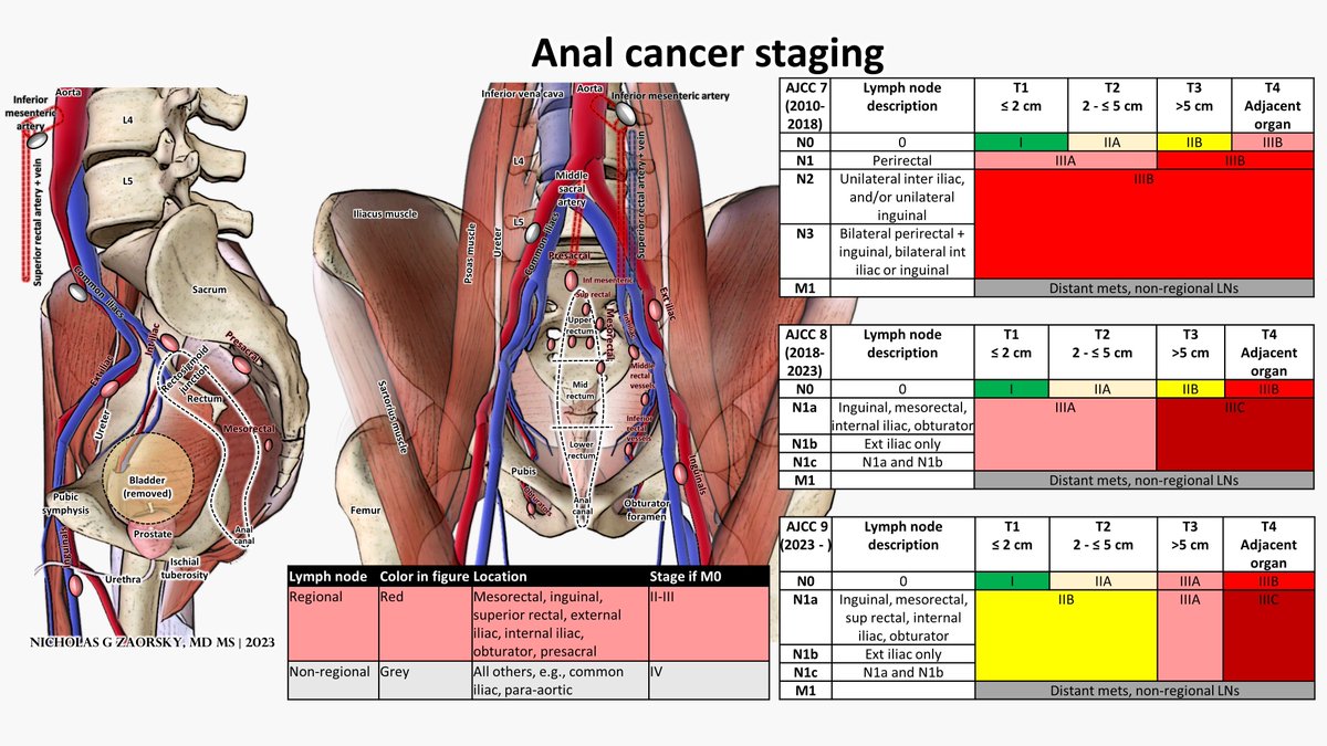 Nicholas Zaorsky, MD MS (@nicholaszaorsky) on Twitter photo Anal cancer staging as fast as possible
<a href="/AJCCancer/">AJCC</a> <a href="/AmericanCancer/">American Cancer Society</a> <a href="/theNCI/">National Cancer Institute</a> Anal cancer staging as fast as possible
<a href="/AJCCancer/">AJCC</a> <a href="/AmericanCancer/">American Cancer Society</a> <a href="/theNCI/">National Cancer Institute</a>