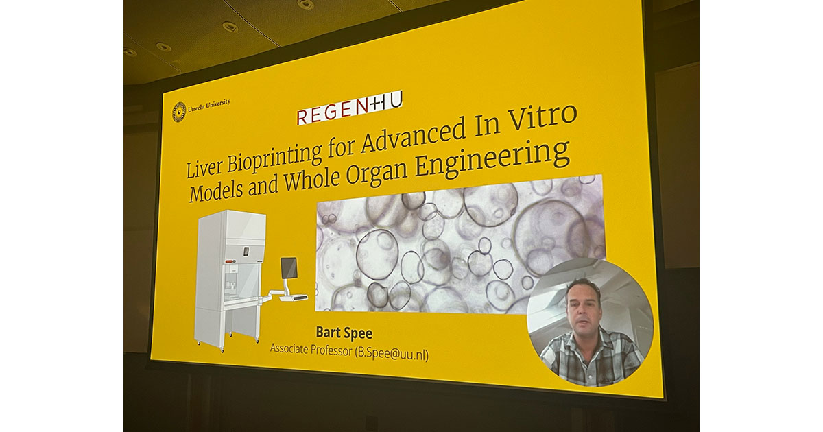 AXT_Australia's tweet photo. Great presentation delivered by Prof. Bart Spree on #bioprinting liver models for #medicalresearch at the #Ausbioprint workshop today organised by @carmine_3Dheart @UTSEngage 

Learn more 👉 https://t.co/pu2NuTXzTw

#bioprinter https://t.co/01ayfIacXu