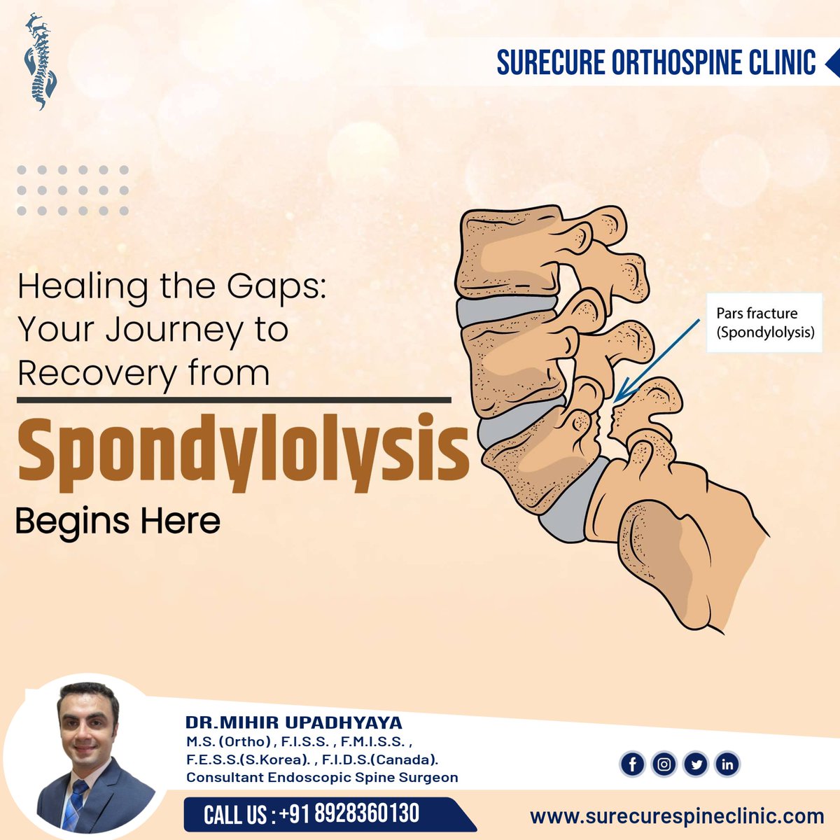 Get back to your active life
#spondylolisis #spondylolisthesis #activelife #spinehealth #spinesurgery #slipdisc #backpain #healthyspine #spinerecovery #spinesurgeon