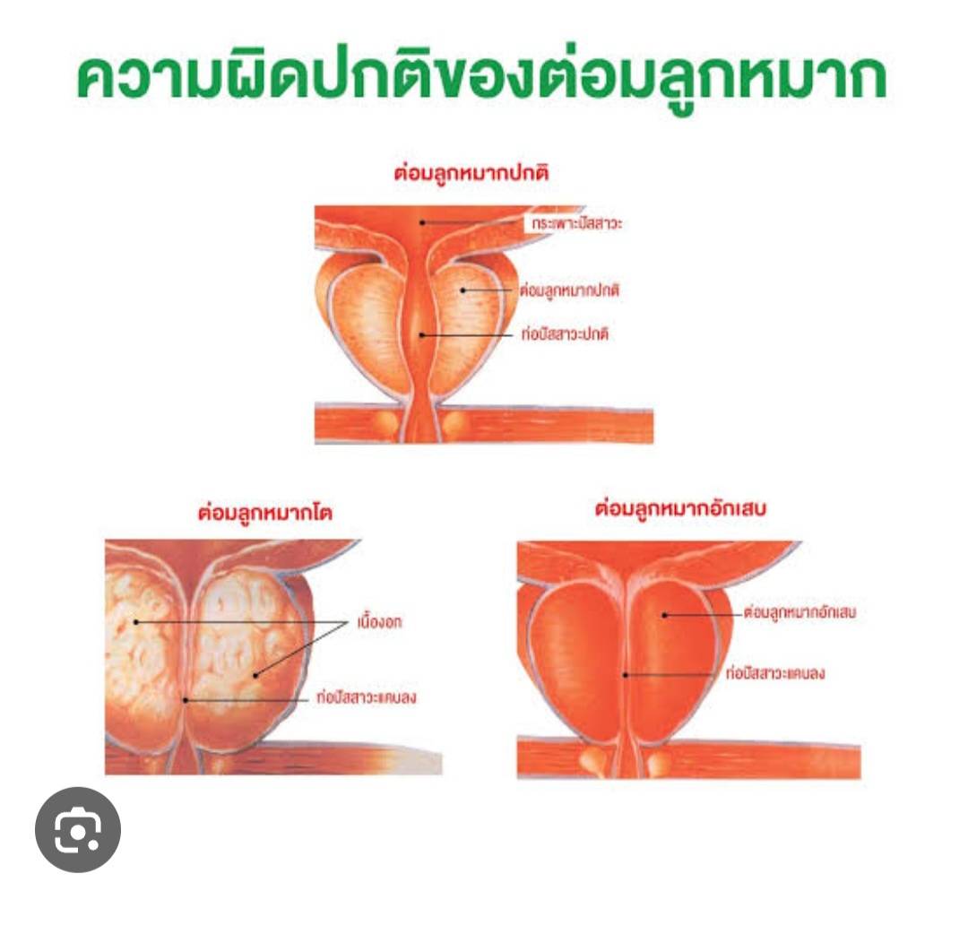 xtimxtim1353080's tweet photo. มีปัญหาเหล่านี้
มานวดมาเช็คต่อมลูกหมากกันค่ะ
หมอไอติม
พระรามสอง50
-ไม่มีแอบแฝง
-ไม่รับนอกสถานที่
นวดจัดโปรๆ
2ชม.1500฿
ID.z2526z
#นวดต่อมลูกหมากชาย
#นวดกษัยแก้อาการเสื่อม
#นวดกษัยแท้ฟื้นฟู
#นวดพระรามสอง https://t.co/Lh4PMYDPls