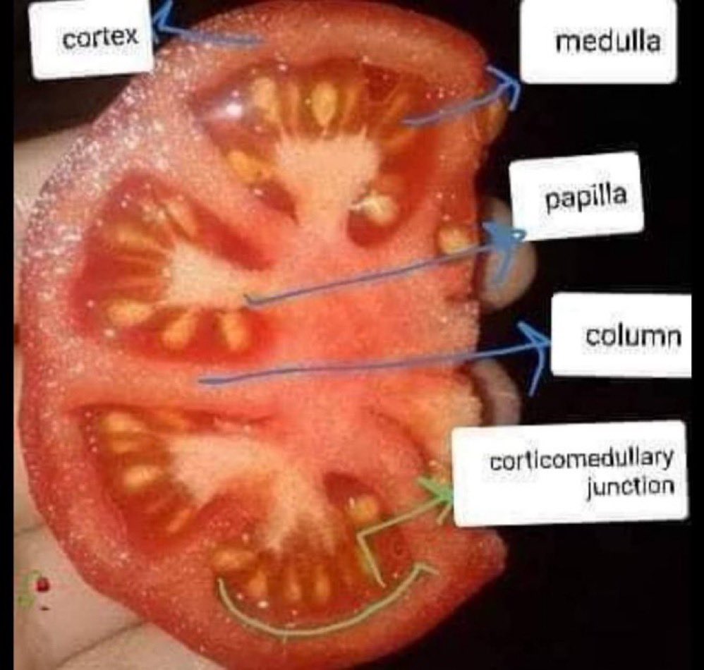 drkeithsiau's tweet image. Anatomy of the kidney 😅🍅
