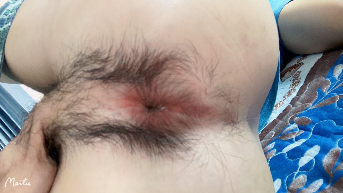 ဒီဖင်မျိုးသာ လိုးခွင့်ရလို့ကတော့ နေ့မနား ညမနား လိုးပစ်မယ် 
လိုးချင်တယ်ကွာ 
#gay
#myanmargay
#xgay
#xnxxgay
#Gaytelegram
#gayTwitter