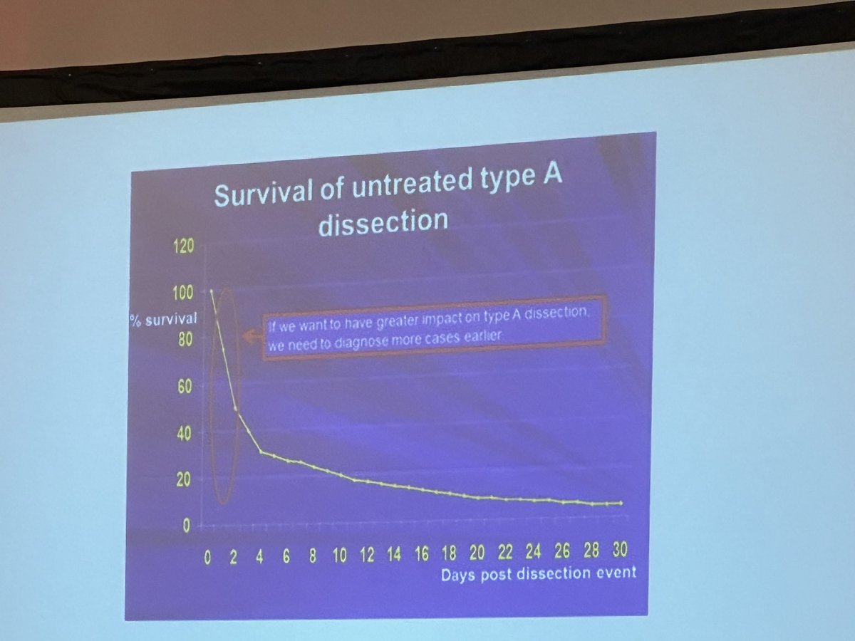 Mary Hynes (@marychynes) on Twitter photo <a href="/DrVipinMehta/">Vipin Mehta</a> presenting on Acute Type A #aorticdissection at today’s NW launch of the National Toolkit, describing the time critical nature of the condition and intervention @aorticdissection <a href="/AorticDissectCT/">Aortic Dissection Charitable Trust</a> <a href="/AorticDissectUK/">Aortic Dissection Awareness UK & Ireland</a> <a href="/GMEC_SCN/">GMEC SCN</a> <a href="/nwcscnSenate/">North West Coast Clinical Network</a> <a href="/MFTnhs/">MFT NHS</a> <a href="/CardiacNwc/">NWC_Cardiac_Network</a> <a href="/DrVipinMehta/">Vipin Mehta</a> presenting on Acute Type A #aorticdissection at today’s NW launch of the National Toolkit, describing the time critical nature of the condition and intervention @aorticdissection <a href="/AorticDissectCT/">Aortic Dissection Charitable Trust</a> <a href="/AorticDissectUK/">Aortic Dissection Awareness UK & Ireland</a> <a href="/GMEC_SCN/">GMEC SCN</a> <a href="/nwcscnSenate/">North West Coast Clinical Network</a> <a href="/MFTnhs/">MFT NHS</a> <a href="/CardiacNwc/">NWC_Cardiac_Network</a>