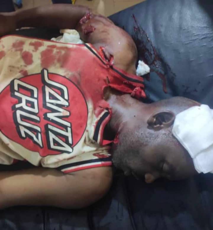 amba_newsline's tweet photo. BREAKING
Ghost town or sit at home today in #Ambaland is so bloody as #Ntarikon Market Bamenda Mezam county was hit with an #explosion by the #ISIS state of Cameroun #Terrorists invading forces in an attempt to #tag Amba forces. Stay home stay safe in #ghost_town. https://t.co/3g4r10B2Tc