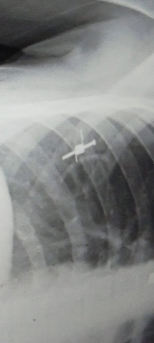 شكل الشظايا الي قطّعت أوصال عائلتي وفجرت وجوههم وقلوبهم وجرحت اطفالهم وجعلتهم ينزفون حتى استشهدوا. الله يرحمكم يا حبايبي. الله معكم يا حبايب قلبي.