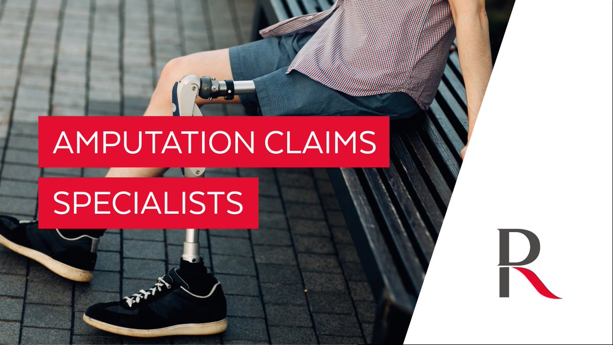 When mistakes made by medical professionals result in an amputation, our expert team of clinical negligence solicitors are here to help. 

Call us today on 0800 027 2557 or fill in the contact form, and a solicitor will get back to you when convenient: bit.ly/3YRjqJi