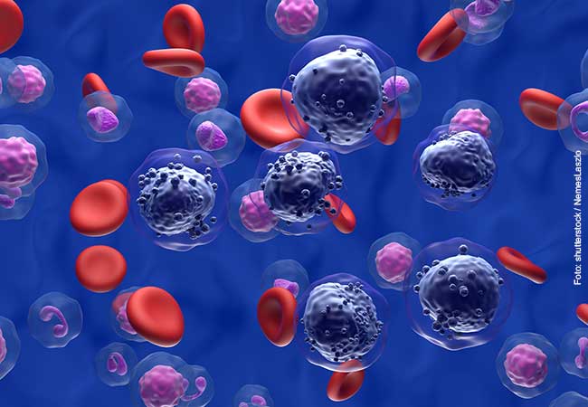 ProLOEWE's tweet photo. 🆕target🎯identified for the treatment of childhood #leukemia. Research team👩🏼‍🔬👨🏿‍🔬 led by Prof. Jan-Henning Klusmann @JHKlusmann @JhKmann from LOEWE-@FCI_health discovers gene🧬essential for the growth of leukemia cells➡️https://t.co/wfimV3ejOy @goetheuni @mpi_hlr @UK_Frankfurt https://t.co/ZePtdgq1wR