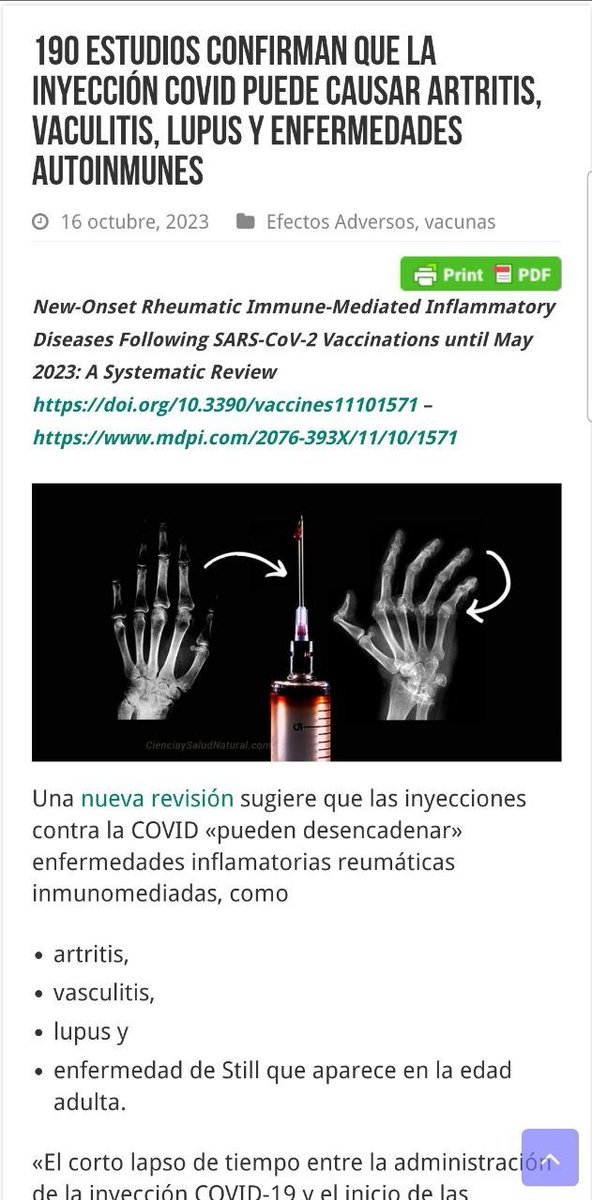 190 estudios confirman que la inyección Covid puede causar artritis, vaculitis, lupus y enfermedades autoinmunes.
Los pacientes desarrollaron enfermedades reumáticas en un promedio 11 días después de la inyección Covid; artritis, vasculitis, lupus y enfermedad de Still. 
Más del
