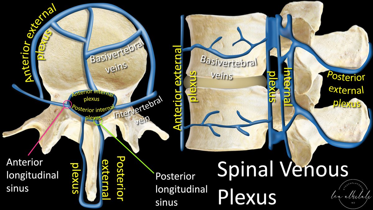 Knowing spinal arterial anatomy is a given Knowing spinal venous anatomy is next level! Vertebral venous plexus can be both good & evil Good for collaterals, bad for tumor spread, infxn & spinal CSF fistulas! Here’s the anatomy you MUST know if you are doing spine 3 rings:…