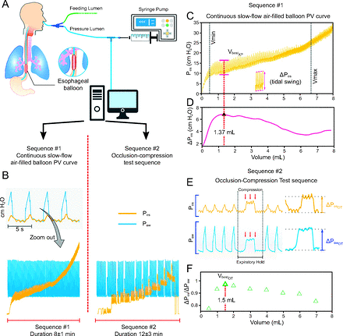 Mari and coworkers provide a short report on a calibration method to record the pressure-volume curve of the esophageal balloon.
rebrand.ly/4tief93