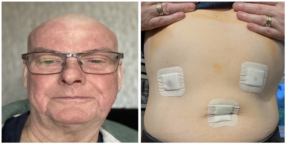 HELP!

I was diagnosed with stomach cancer in June &amp; currently having chemo. I've been told that I'll get half pay in December then SSP from 1st January which means I'm going to really struggle financially. Please read my story below.

Please donate at gofund.me/a8a9cd84