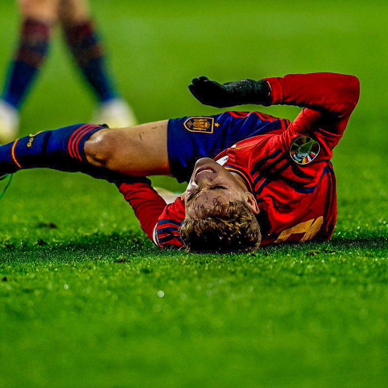 Sports_Doctor2's tweet photo. “ABC OF GAVI’S SEASON ENDING INJURY”

This morning it was confirmed that 19yr old Barca and Spain midfielder Gavi has suffered a COMPLETE ACL TEAR and INJURY to the LATERAL MENISCUS.

I know the medical terminologies are a lot but in this thread, I will break them down to bits.

#OdogwuTales