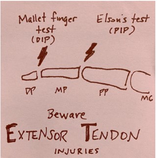 #EPs should watch out for #extensor #tendon injuries of the #finger, says @M_Lin, because they can lead to chronic deformities and disability. Here are some tips to remember. tinyurl.com/4paphf6t #FOAMed