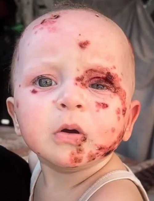 حشدوا السلاح والدعم الدولي
ليقتلوا طفلًا
ويقصفوا مستشفى وجامع وكنيسة
#جرائم_حرب
#فلسطين_الان #غزة_الآن #Ghaza