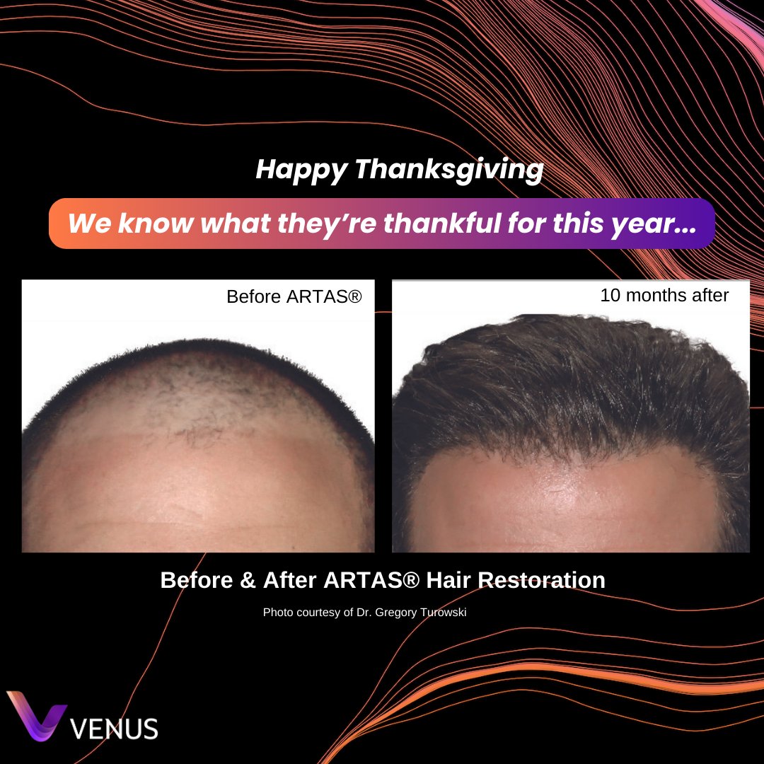 VenusHairAI's tweet photo. 🍁 Get Your Hair Back Today &amp; Give Yourself Something to Be Thankful for 🍂

* Minimally Invasive
* Natural-Looking Results
* Minimal Downtime
* High Satisfaction: Rated "Worth It" by 95% on https://t.co/29c6FU65XC.

https://t.co/h3vZ4CD4L2 https://t.co/FwWPJyglK8