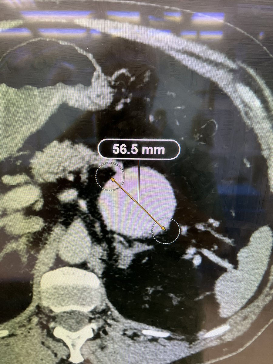 André Poci tweet media