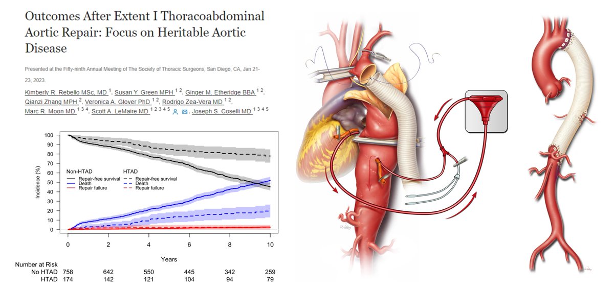 Outcomes After Extent I Thoracoabdominal Aortic Repair Over 3 decades!🤠👍 177 #HeritableAorticDisease 45 yr 815 non-HTAD 69 yr HTAD👤 has a lower risk of operative death & late repair failure #AortaEd @scottlemaire @JCoselli_MD @annalsthorsurg 2023 sciencedirect.com/science/articl…