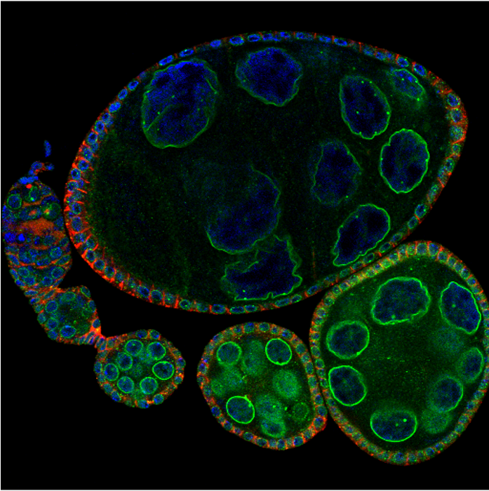 ISMMSscopes's tweet photo. Always happy to see beautiful work of our users ! Thank you @shr_venkat from @RanganLab @CDRBSinai for sharing colorful fruit fly germline confocal #Microscopy images taken with our @zeiss_micro LSM980 😍🔬 https://t.co/QHSiAlnlGr