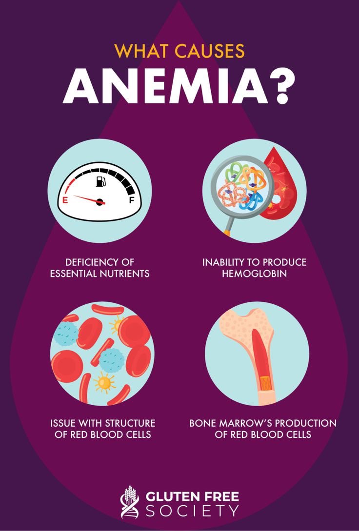 anemiawebsite's tweet photo. What is the main reason for anemia ? https://t.co/kIW1epkUe5