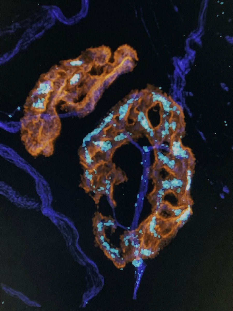 Mitochondria (cyan) staining in the neuromuscular junctions from wholemount dissected lumbricals, variety observed. (magnification 63x)

Not that scientifically related, but by choosing this pseudo color, it reminds me of beautiful falling autumn leaves 🍂
