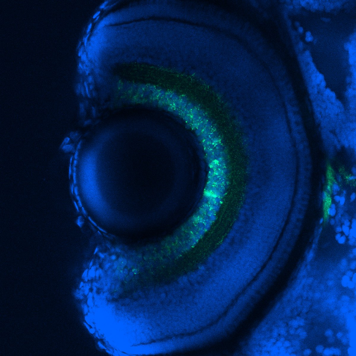 Research Ireland (@researchirel) on Twitter photo Research Image of the Year Award goes to <a href="/ElinStrachan/">Elin Strachan</a>, <a href="/ucddublin/">University College Dublin</a>, for 'I C You'. This image displays the head (specifically the eye) of a 5 day old zebrafish larva. The blue stain shows the cell nuclei & the green labelling are the mitochondria within the animal’s optic nerve. Research Image of the Year Award goes to <a href="/ElinStrachan/">Elin Strachan</a>, <a href="/ucddublin/">University College Dublin</a>, for 'I C You'. This image displays the head (specifically the eye) of a 5 day old zebrafish larva. The blue stain shows the cell nuclei & the green labelling are the mitochondria within the animal’s optic nerve.