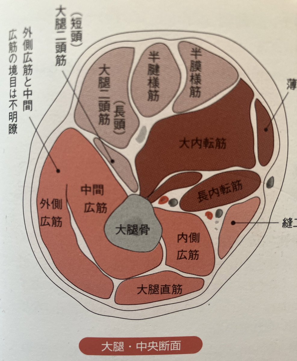 renaipartner's tweet photo. 【スキニーがきつい】
太ももが張る、太くなる原因。
添付張る太ももの筋肉断面図。大腿四頭筋をみると中間広筋・外側広筋の割合が大きい。過剰な使用、むくみ、硬さがでると太くなりやすい。ストレッチや筋膜リリースで柔らかくしよう。また反対側の筋肉を使える様になろう。#ダイエット https://t.co/kHHBU6SGQc