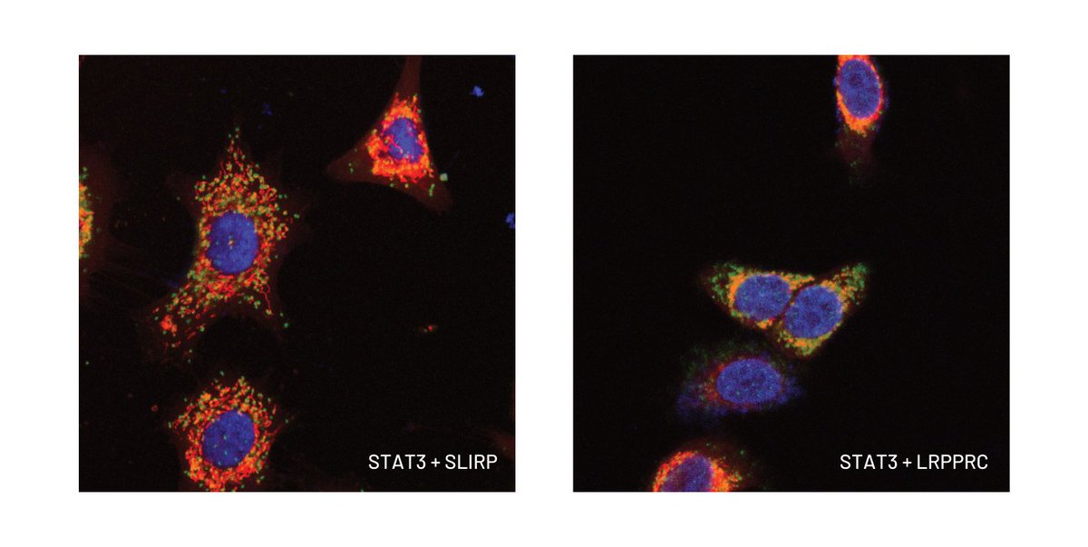A/Prof Daniel Gough, Dr Daniel Garama &amp; the team have now identified the processes that #Cancer cells use to create the energy they need to grow.

Read their latest research, on a particular protein called #STAT3, in the journal Cell Reports, or 👉🏾bit.ly/3GbNIPH