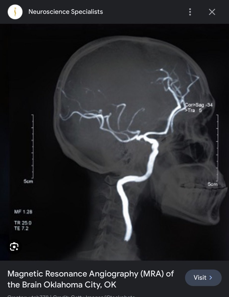 JohnHalbleib's tweet photo. @angel_0f_deathx Magnetic Resonance Angiography? That’s super important for looking at blood vessels. What’s he got against that??? https://t.co/ZifCxkR5PM