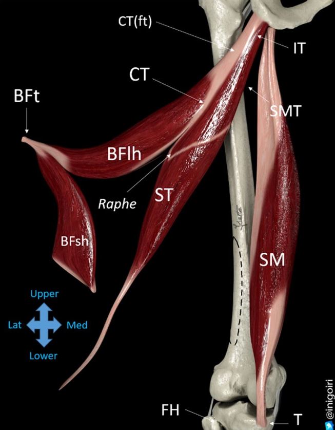 With our hamstring webinar coming up on the 7th of December we thought we'd share some of our favourite hamstring articles.
ARTICLE 1: Sonographic landmarks in hamstring muscles
bitly.ws/32Srs
mskaustralia.com.au