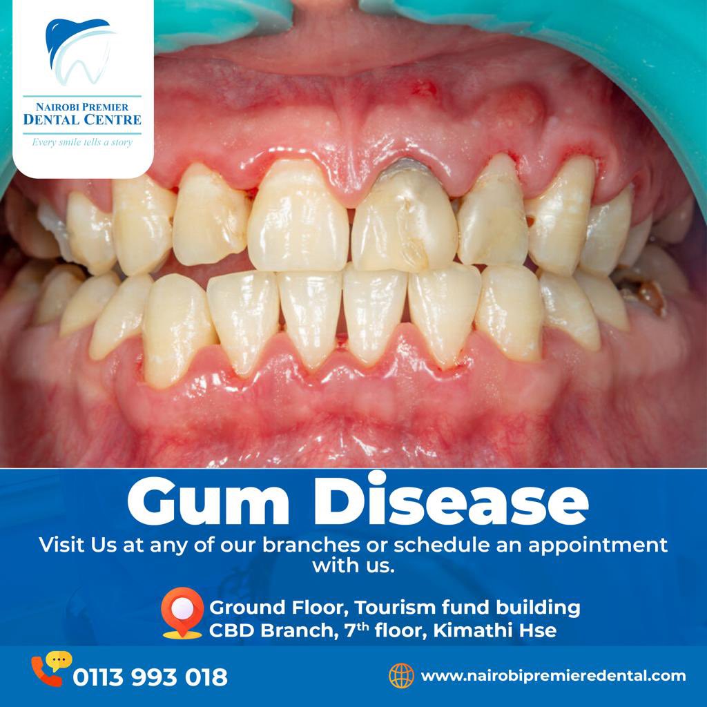 ToothsDay tweet media