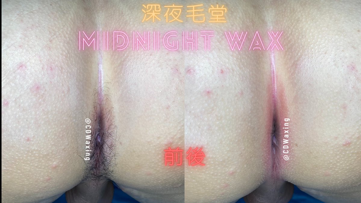 CDWaxing's tweet photo. 192職軍小哥哥又來了🪖

這次選造型給女友一個驚喜🥳

還特別強調在軍中沒除屁屁
非常之不舒服🤬
不要再覺得除屁股奇怪拉！
體驗一次就知道✌🏼

#桃園 #熱蠟除毛 #深夜毛堂 #男仕熱蠟除毛 #偽娘 #獨立工作室 #私密部除毛 #除毛作品 https://t.co/gRXJUe8RJJ