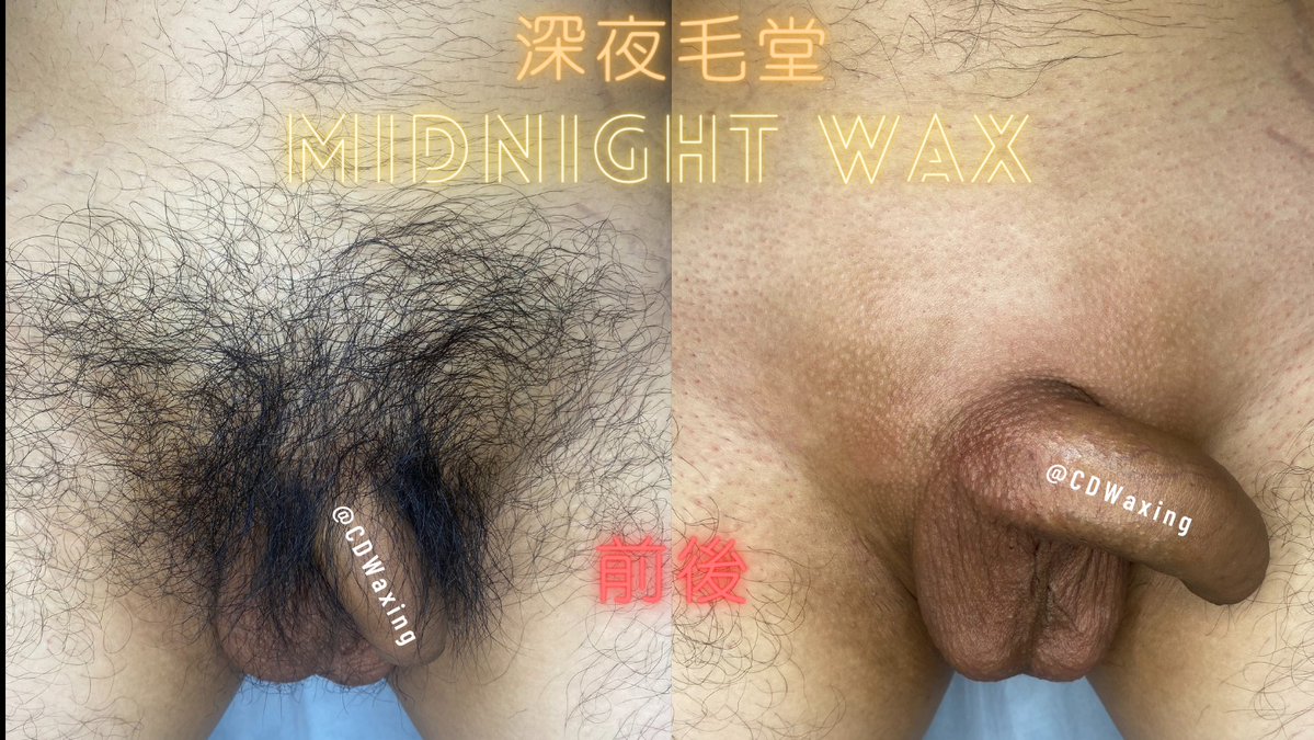 CDWaxing's tweet photo. 住藝文特區的小哥哥來除毛😎

完全沒除過的小哥哥來初體驗🤣
擺脫雜毛🤬🤬

#桃園 #熱蠟除毛 #深夜毛堂 #男仕熱蠟除毛 #偽娘 #獨立工作室 #私密部除毛 #除毛作品 https://t.co/OqKc1S1Bsp