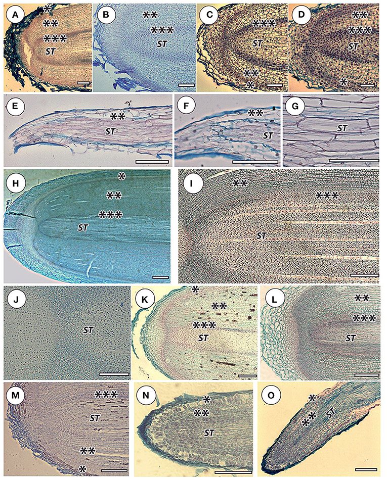 Om Prakash (@baizalla) on Twitter photo A beautiful study on comparing the relative growth rate of aerial vs substrate roots (Eskov et al., 2022). The root growth in the elongation zone was found to be prolonged and slower in aerial roots. #roots #belowground #hiddenhalf <a href="/RootBiologyNews/">Root Biology News</a>
frontiersin.org/articles/10.33… A beautiful study on comparing the relative growth rate of aerial vs substrate roots (Eskov et al., 2022). The root growth in the elongation zone was found to be prolonged and slower in aerial roots. #roots #belowground #hiddenhalf <a href="/RootBiologyNews/">Root Biology News</a>
frontiersin.org/articles/10.33…