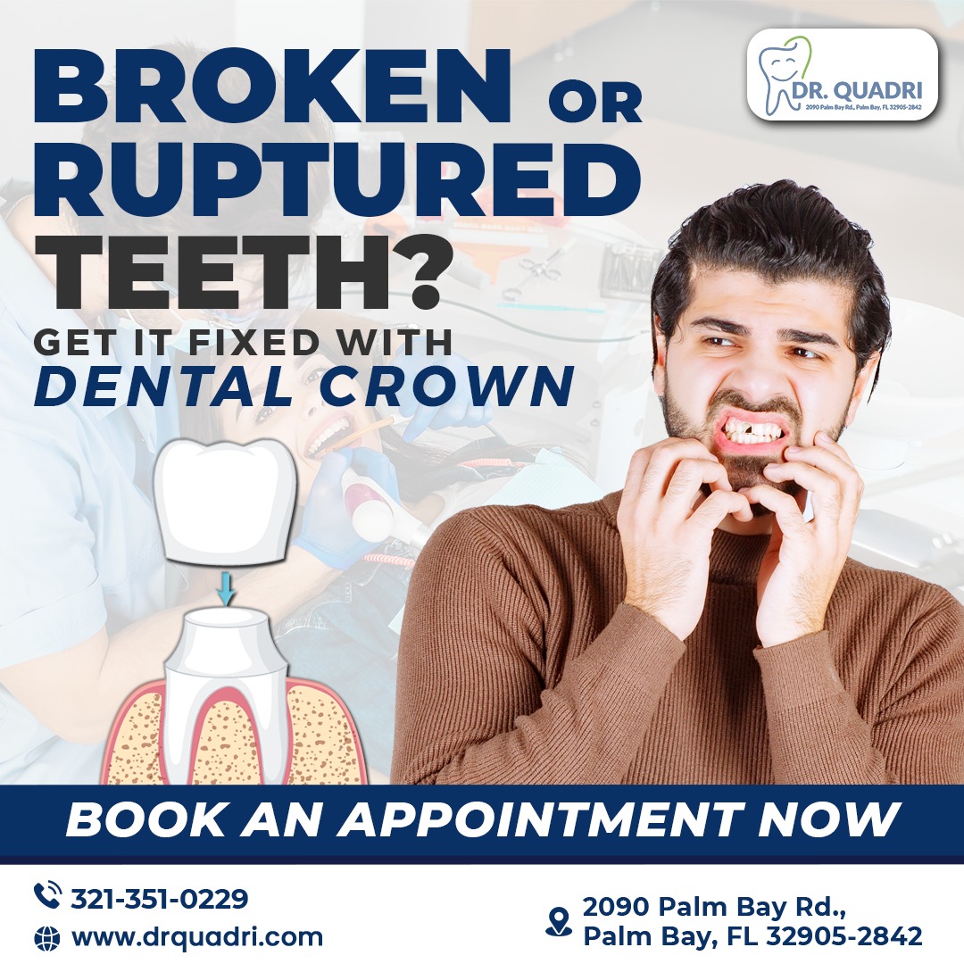 Cracked or Ruptured Teeth? Don't Worry, We've Got You Covered

Get Them Fixed with Dental Crowns and Restore Your Smile's Strength and Beauty.
📲 1 321-984-2255

#SmileRestoration #DentalCrowns #CrackedTeethNoMore #SmileMakeover #ToothRestoration #DentalCare #FixYourSmile