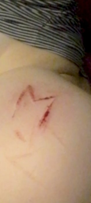 ilov3cut's tweet photo. rt :(?
for my babe 💌!¡
#sadgirl #sadic #blood #bf #love #cut #babycut https://t.co/IVi8Ss9DA0