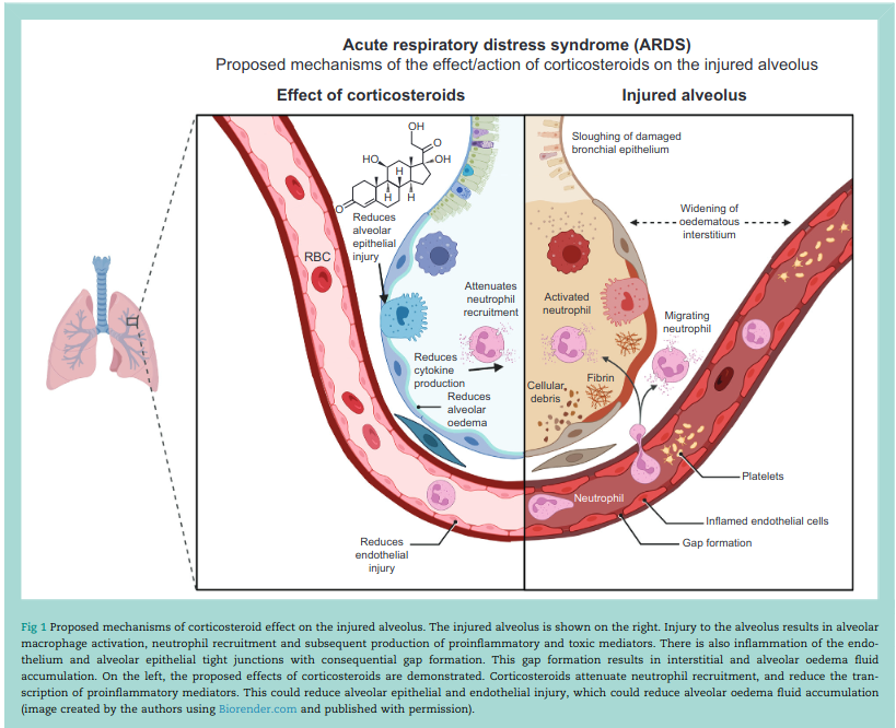 CritCareReviews's tweet photo. Corticosteroids in adults with acute respiratory distress syndrome and severe pneumonia (by @D_Jayasimhan)

CCR Journal Watch
https://t.co/Sp06oA6IDG

Get the latest critical care literature every weekend via the CCR Newsletter - subscribe at https://t.co/nitMzacLrj https://t.co/9o30hWZk4F
