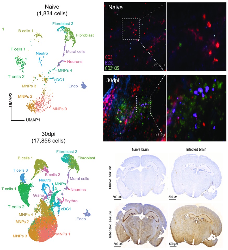 PLOSBiology's tweet photo. Chronic #trypanosome brain infection induces meningeal responses resulting in ectopic lymphoid aggregates containing #autoreactiveBcells; #autoantigens include MBP, consistent with experimentally observed #demyelination @Jquintanalcala &amp;co #PLOSBiology https://t.co/SysFot9P57 https://t.co/uMOzyD2yNk