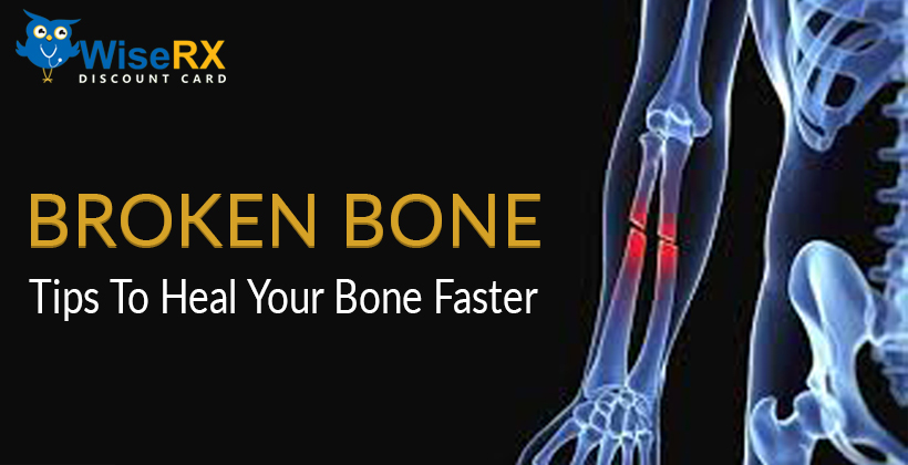 BROKEN BONE: TIPS TO HEAL YOUR BONE FASTER

Explore 'Broken Bone: Tips to Heal Your Bone Faster' and discover actionable steps to accelerate your recovery. From proper nutrition to gentle exercises, these tips empower your healing journey. 
wiserxcard.com/broken-bone-ti…