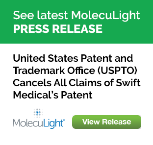 MolecuLight Inc. (@moleculight) on Twitter photo PRESS RELEASE: United States Patent and Trademark Office (USPTO) Cancels All Claims of Swift Medical’s Patent. <a href="/moleculight/">MolecuLight Inc.</a> Victorious in its Efforts to Prove Swift Medical Did Not Merit a Patent tinyurl.com/2p8naafn PRESS RELEASE: United States Patent and Trademark Office (USPTO) Cancels All Claims of Swift Medical’s Patent. <a href="/moleculight/">MolecuLight Inc.</a> Victorious in its Efforts to Prove Swift Medical Did Not Merit a Patent tinyurl.com/2p8naafn