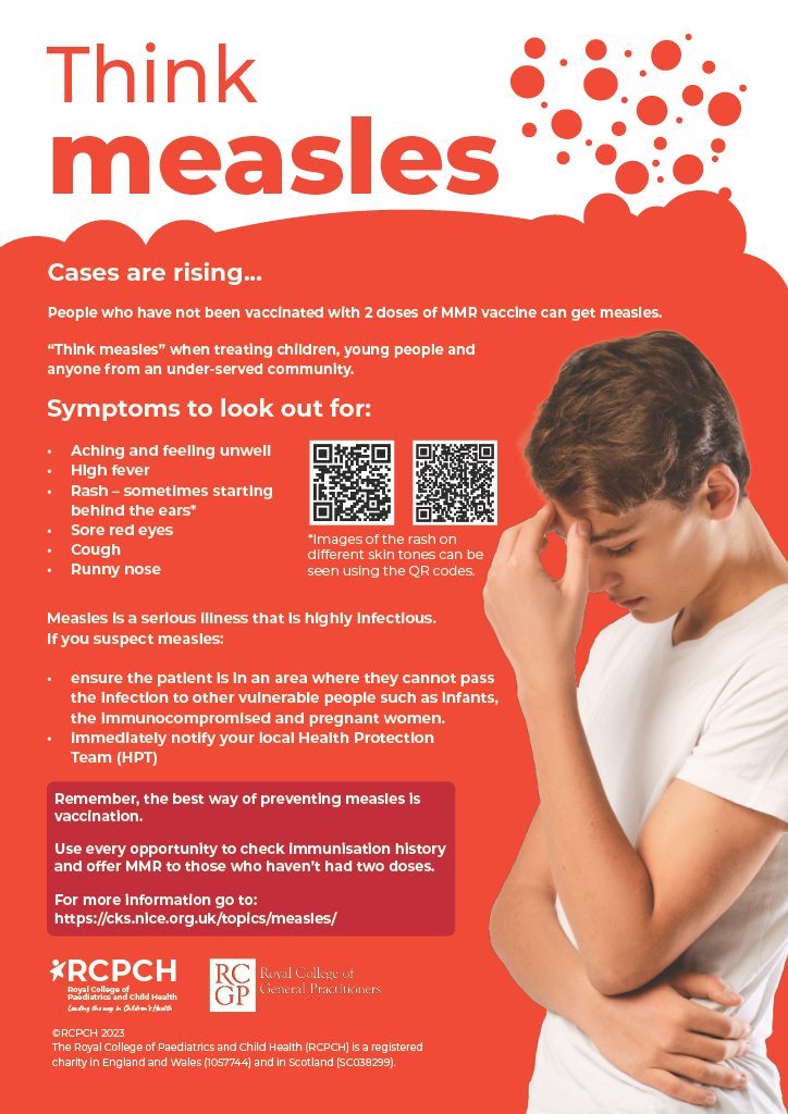 Think Measles ❗📄 Our new poster with @rcgp encourages healthcare professionals to ‘think measles’ when treating children, young people and anyone from an underserved community. Download and share with your networks 👇 rcpch.ac.uk/resources/thin…