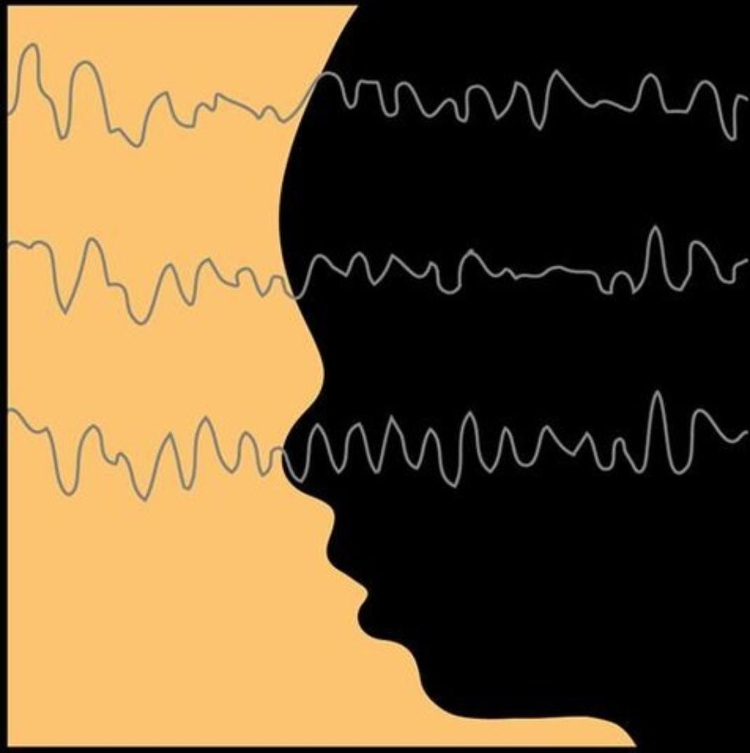 snwhealth's tweet image. The use of a suitably trained, artificial intelligence, expert system can detect epileptiform abnormalities in the EEG with accuracy comparable to that of human experts.

Link - jamanetwork.com/journals/jaman…

#Anesthesiology  #Anesthesia #AI #snwhealth #snwareresearch